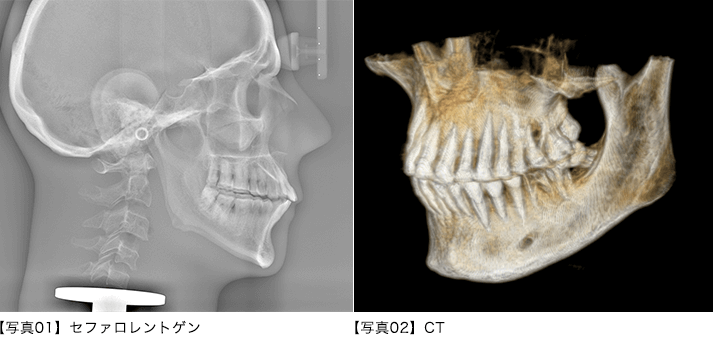 矯正歯科に通うことを楽しみにしていただけるような、そんなクリニックでありたいと思っています。